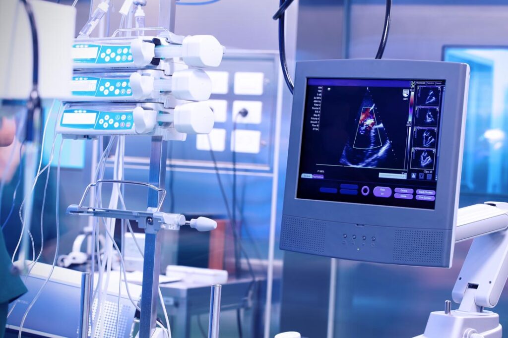 An ultrasound machine in a hospital operating room